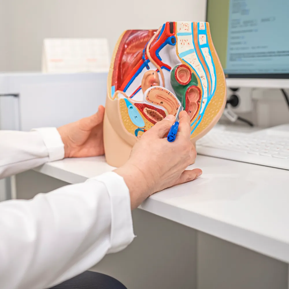 Свищ прямой кишки